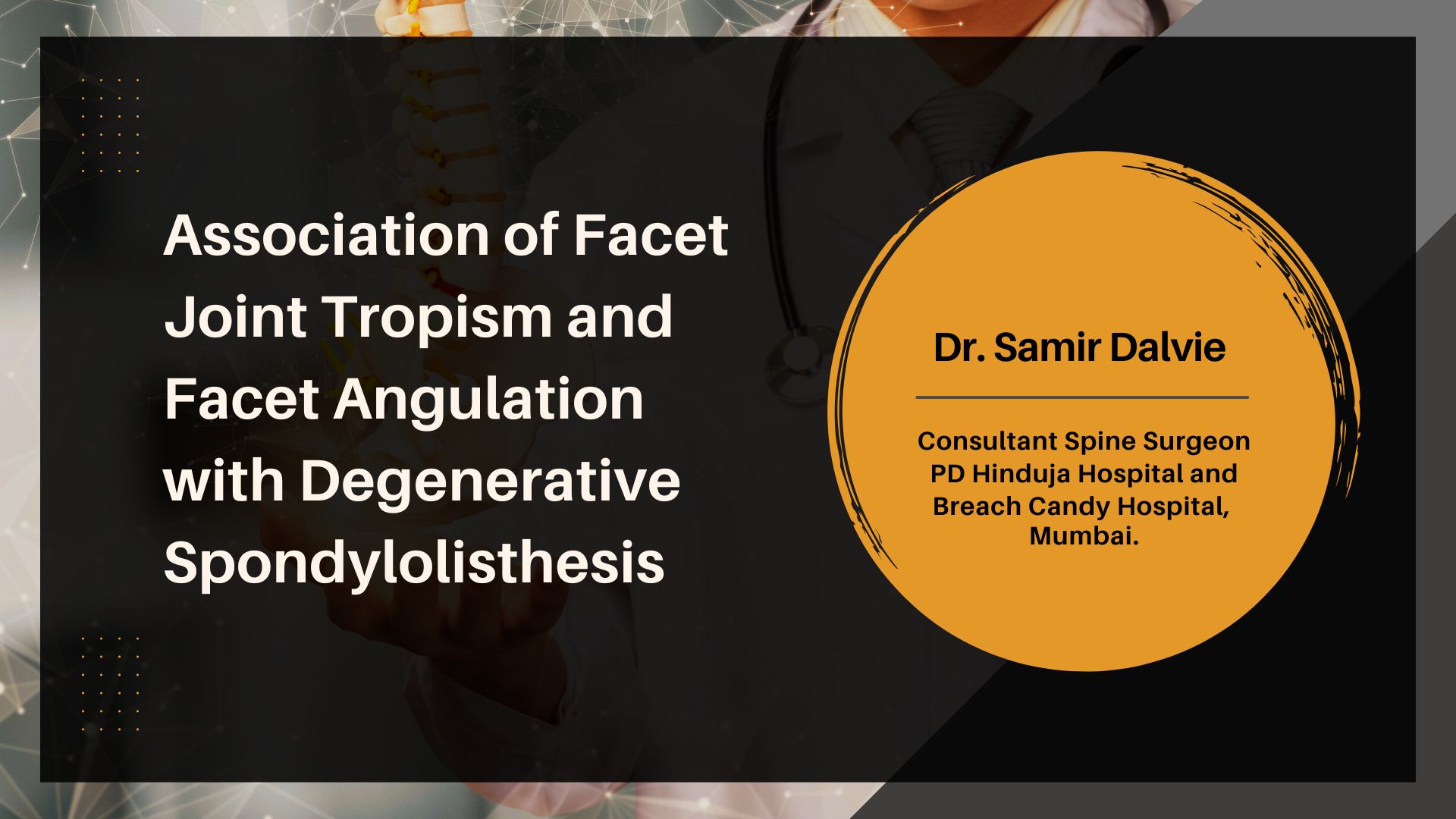A Radiological Study of the Association of Facet Joint Tropism and Facet Angulation With Degenerative Spondylolisthesis
