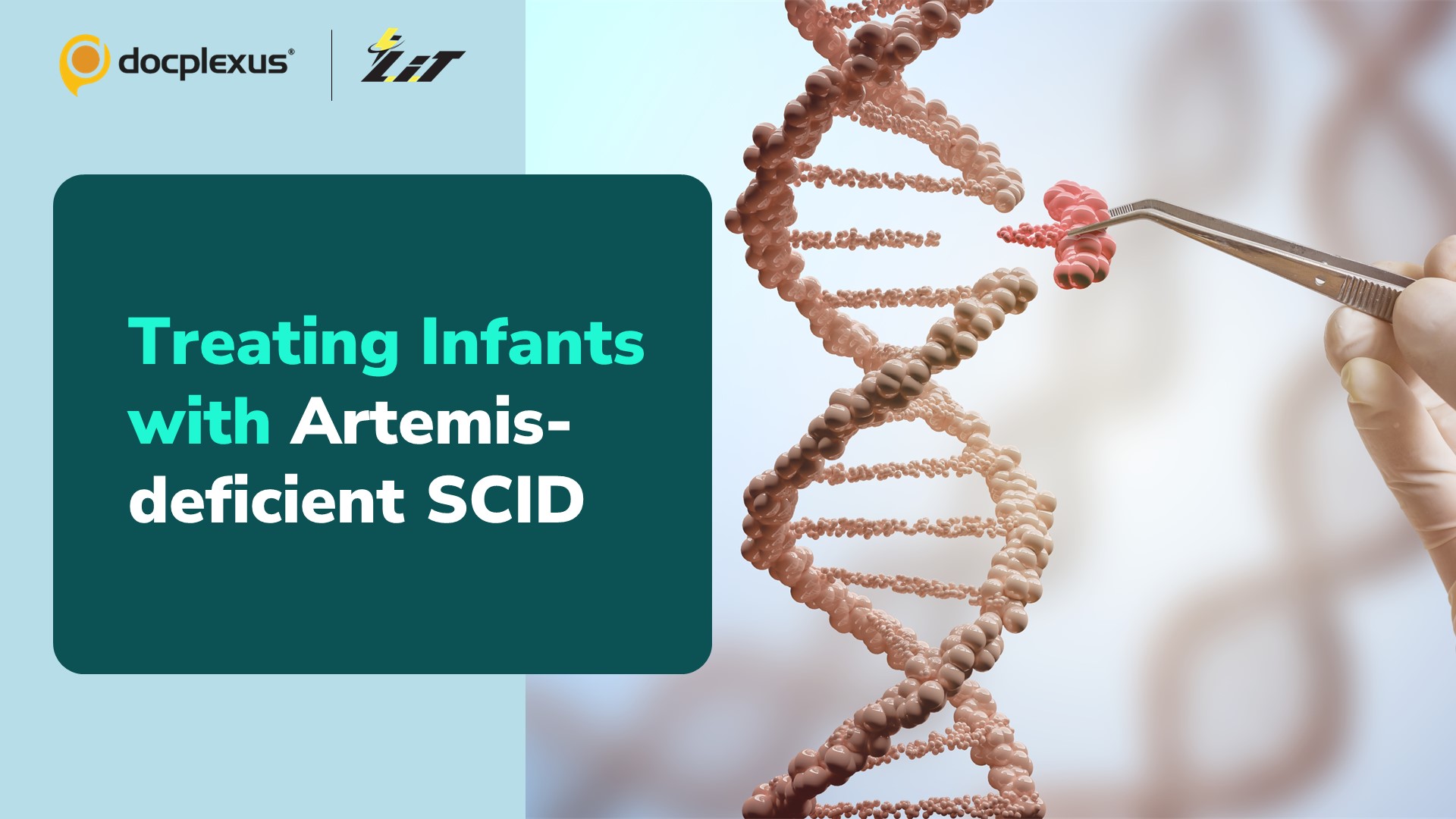 New Gene Therapy for Artemis-deficient SCID