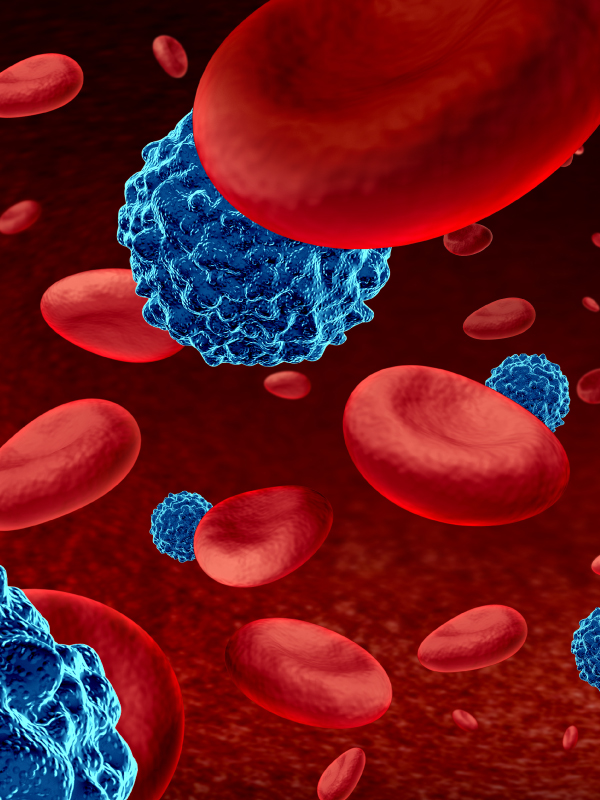 Treatment of Advanced HCC & Multiple Myeloma
