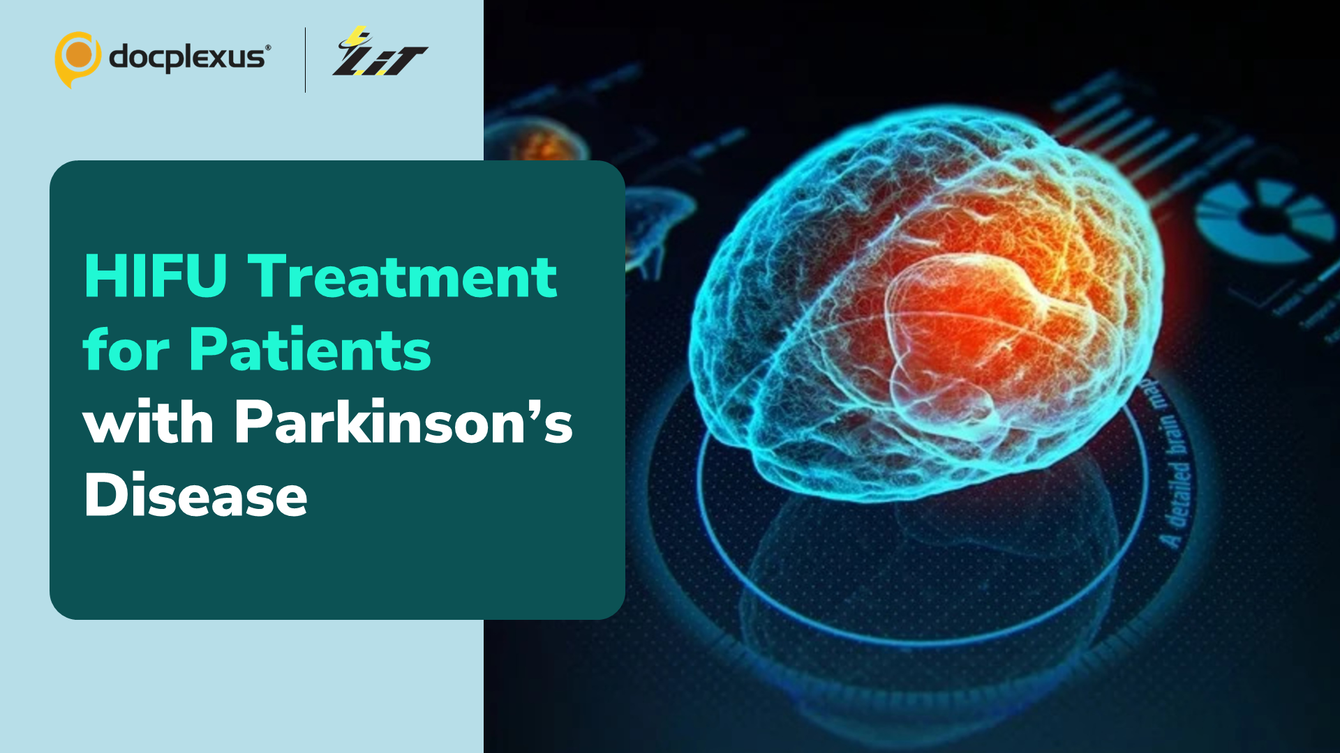 A Novel Treatment for Parkinson’s Disease