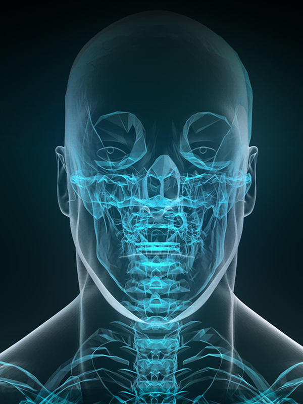 Head and Neck Reconstruction