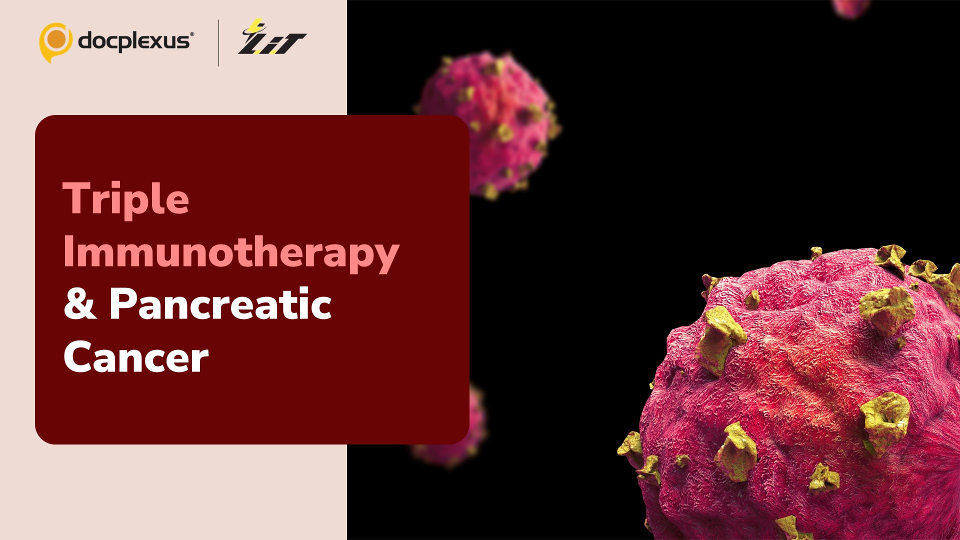 Treating Pancreatic Cancers: A New Hope