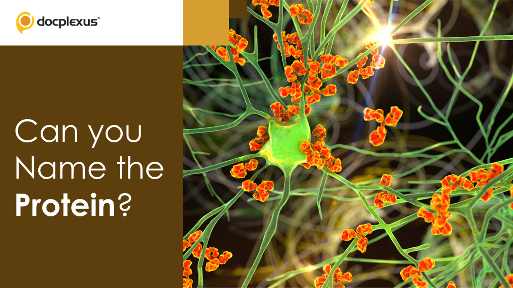 An Autoimmune Disease of the Central Nervous System