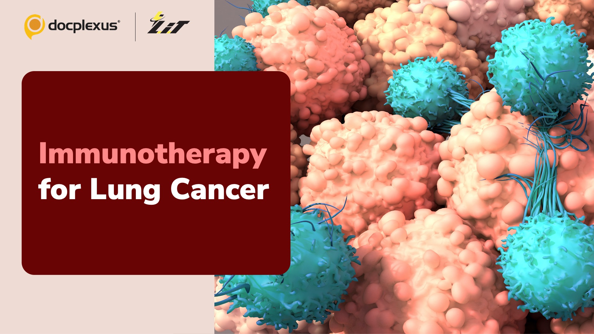 Why Does Lung Cancer Not Respond Well to Immunotherapy?