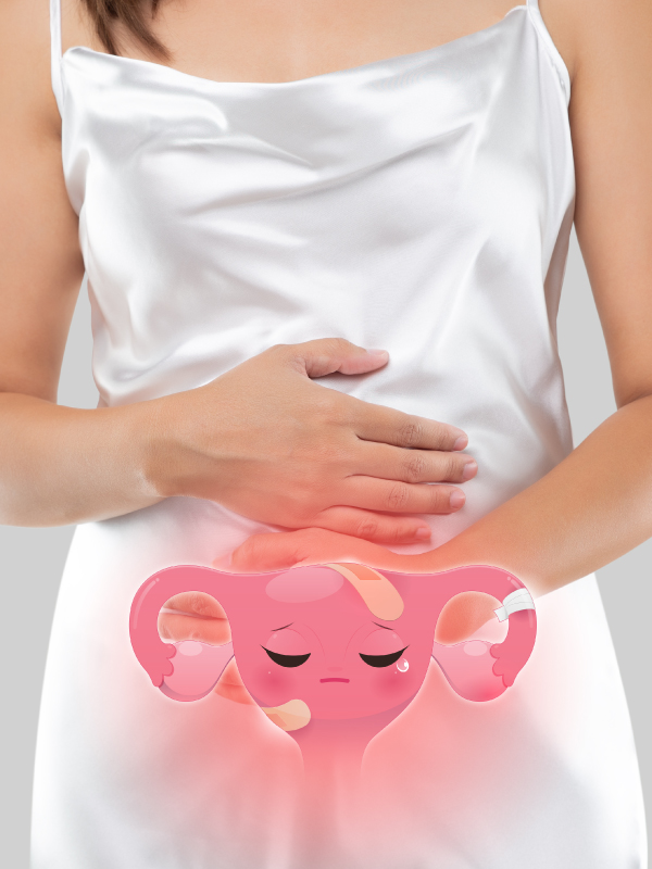 Management of Infertility with Endometriosis