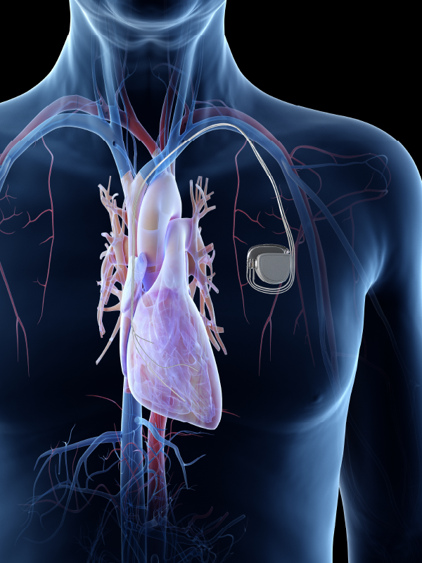 The Present and Future of Device-based Care in Heart Failure Patients