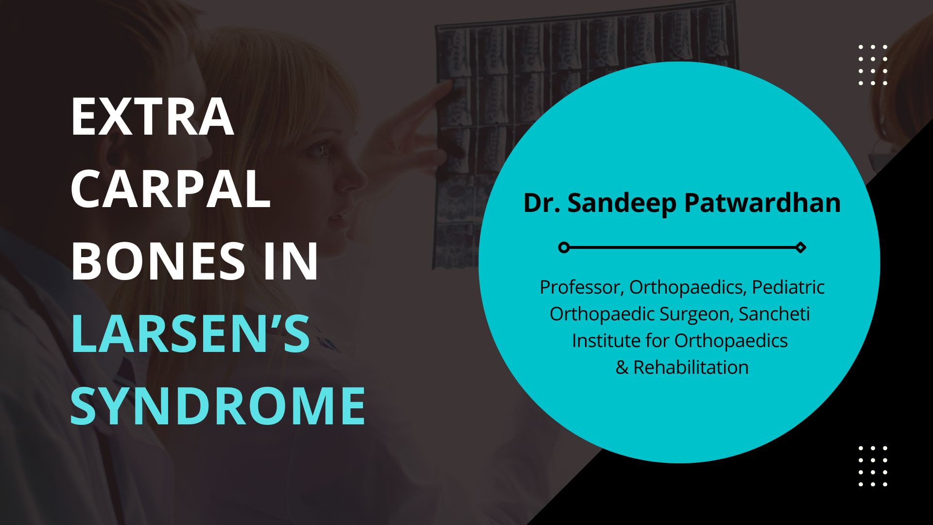 Extra Carpal Bones in Larsen’s Syndrome