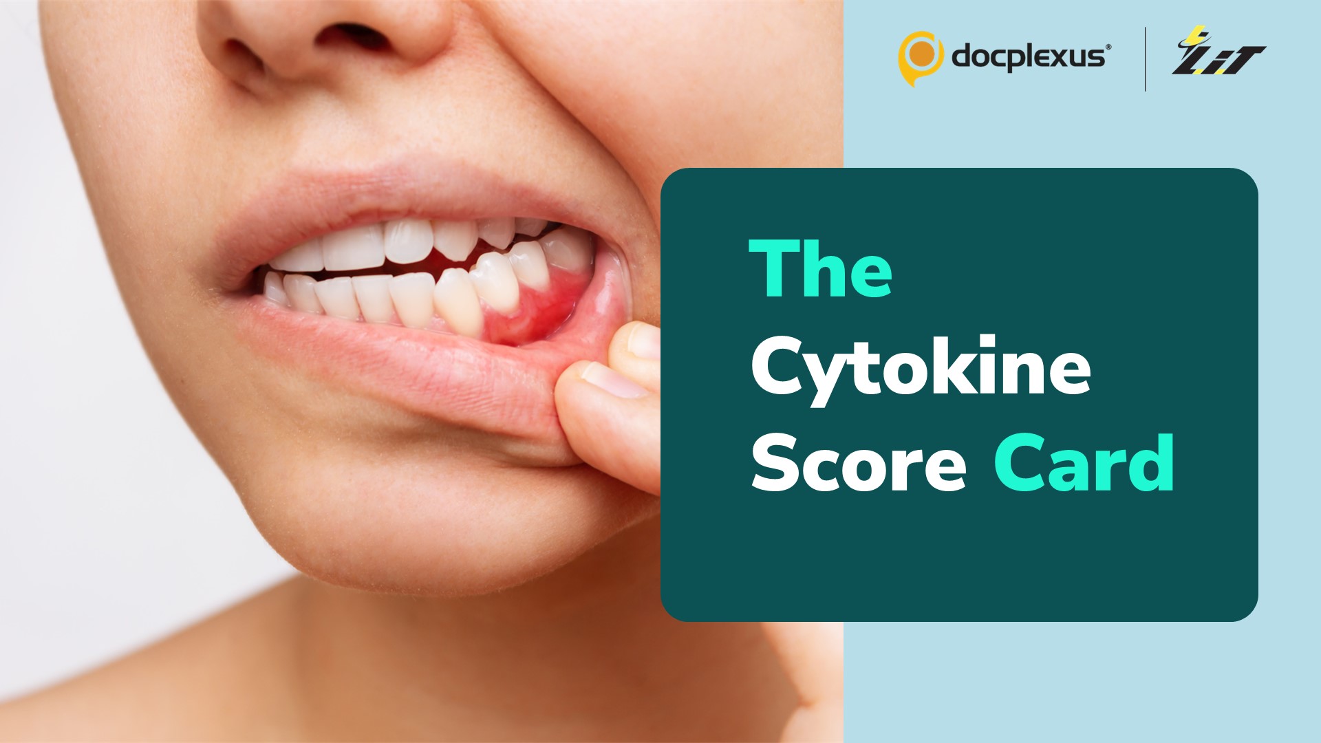 Does Cytokine in Saliva Indicate Gum Inflammation?
