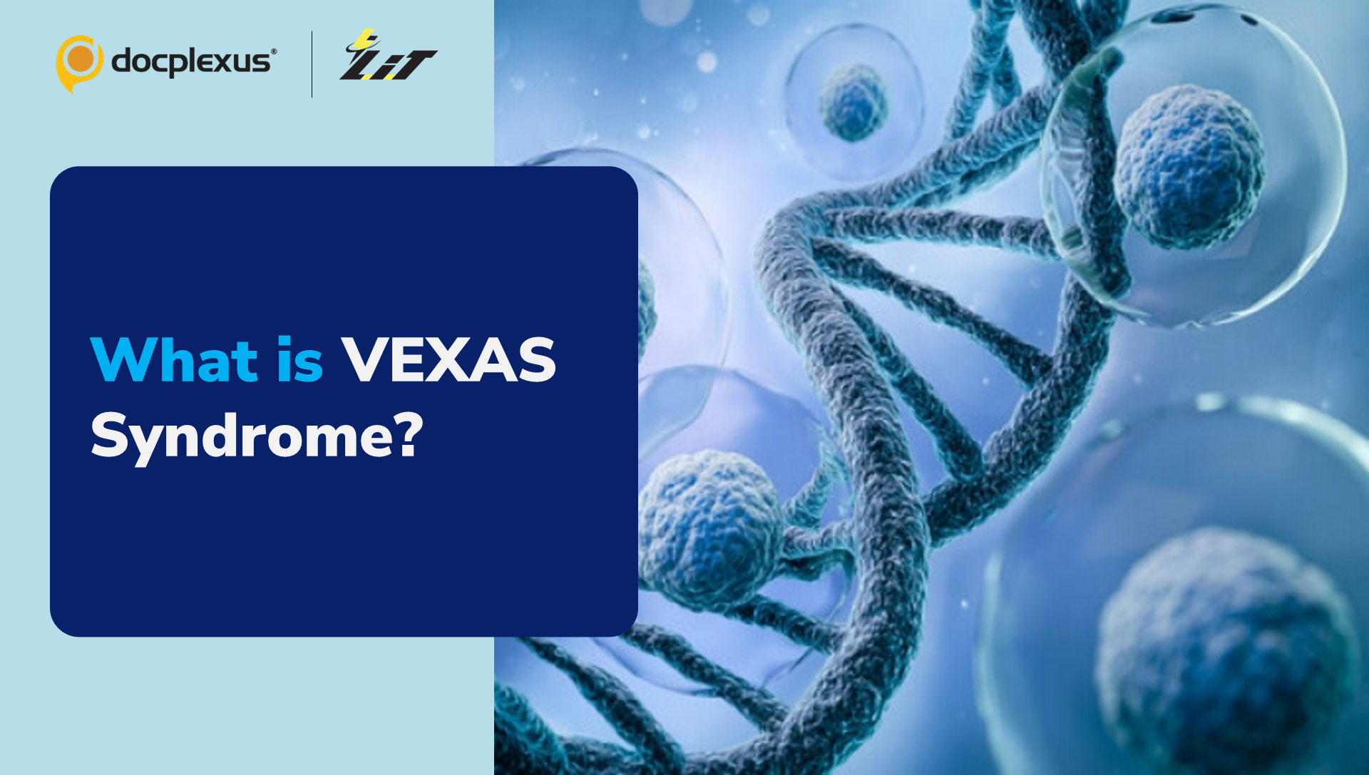 VEXAS Syndrome: A New Rheumatological Disorder