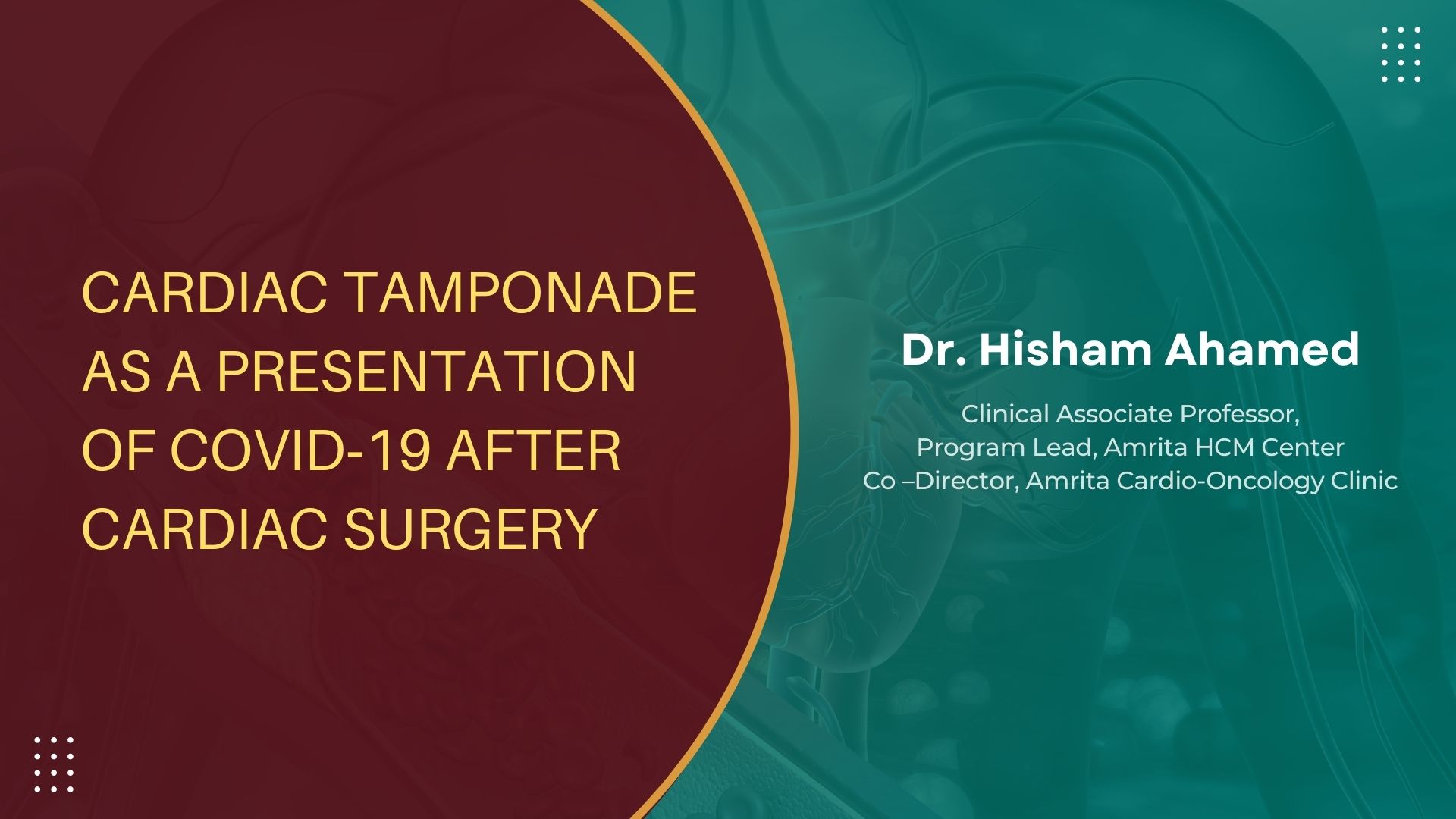 Cardiac Tamponade As a Presentation of COVID‑19 After Cardiac Surgery