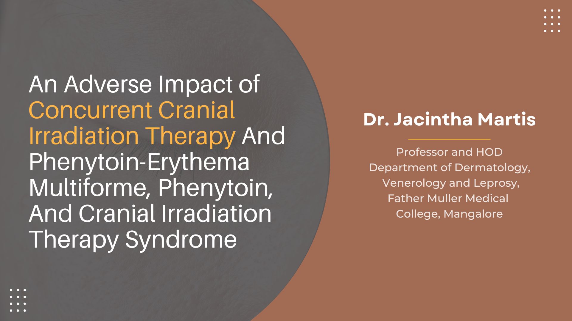 An Adverse Impact Of Concurrent Cranial Irradiation Therapy And Phenytoin-erythema Multiforme, Phenytoin, And Cranial Irradiation Therapy Syndrome