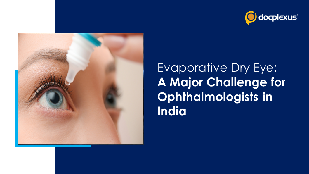 Evaporative Dry Eye Management: An Indian Perspective