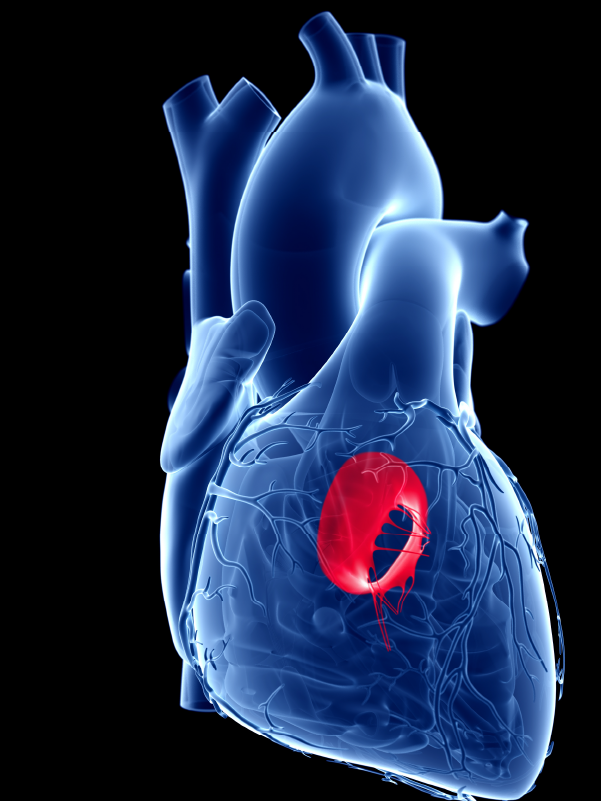 Endoscopic Mitral Valve Surgery