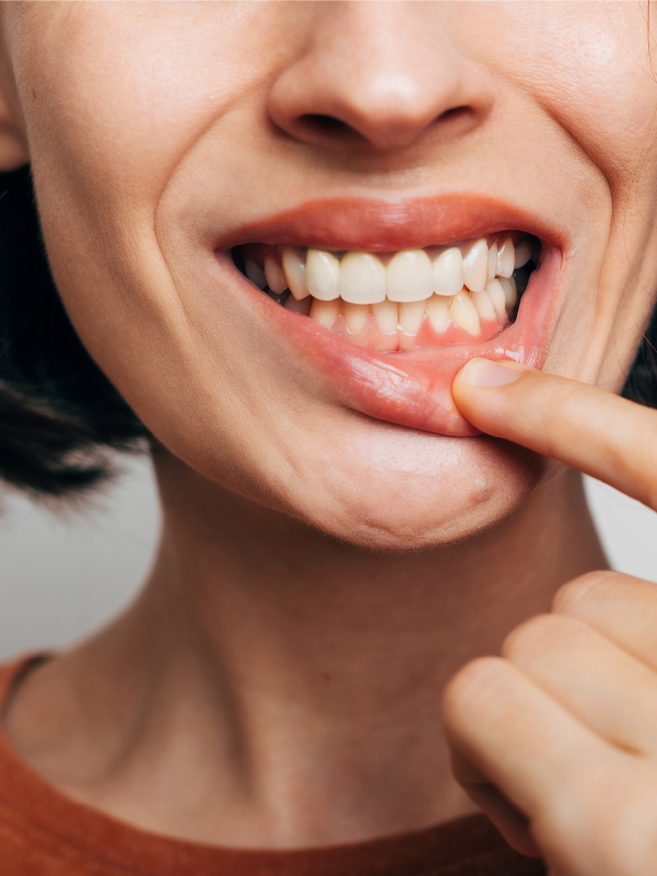 Periodontal Disease: A Genetic Perspective