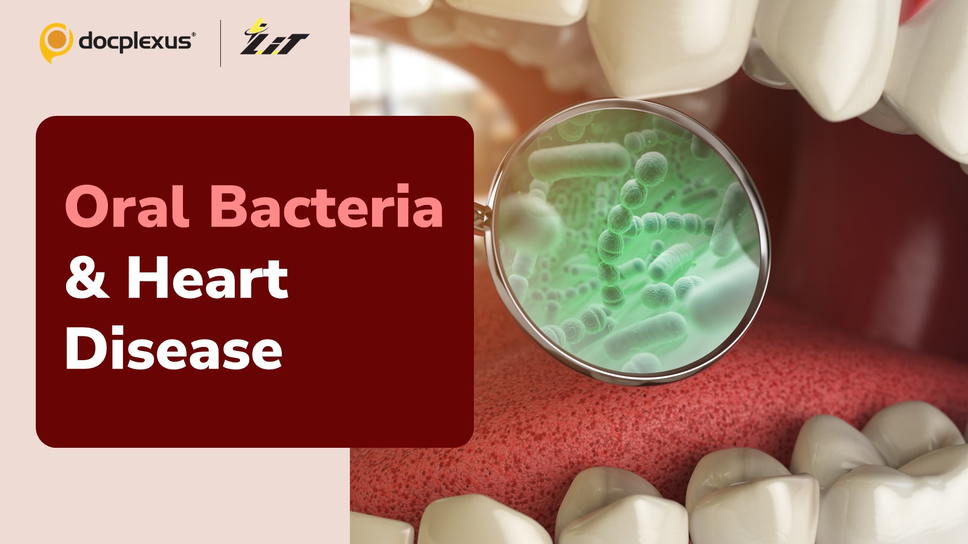 Link Between Oral Bacteria and Heart Disease