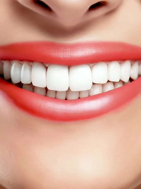 Adult Orthodontics