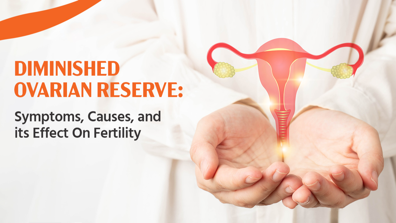Diminished Ovarian Reserve: Symptoms, causes, and its Effects on Fertility
