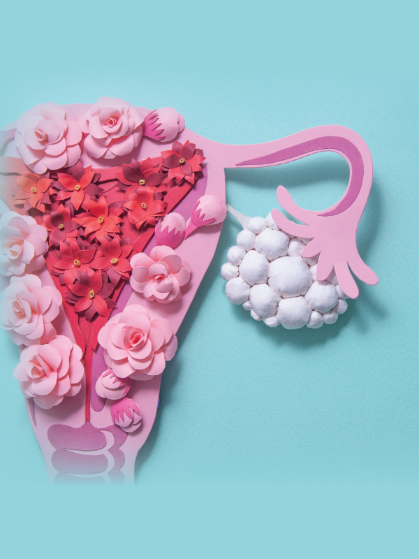 Fertility and PCOS: Everything You Need to Know?