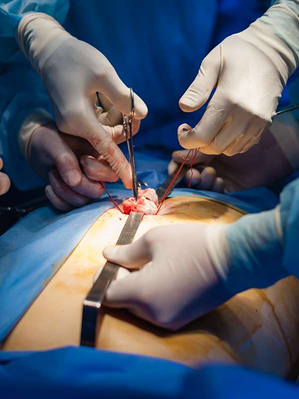 Difficult Laparoscopic Cholecystectomy