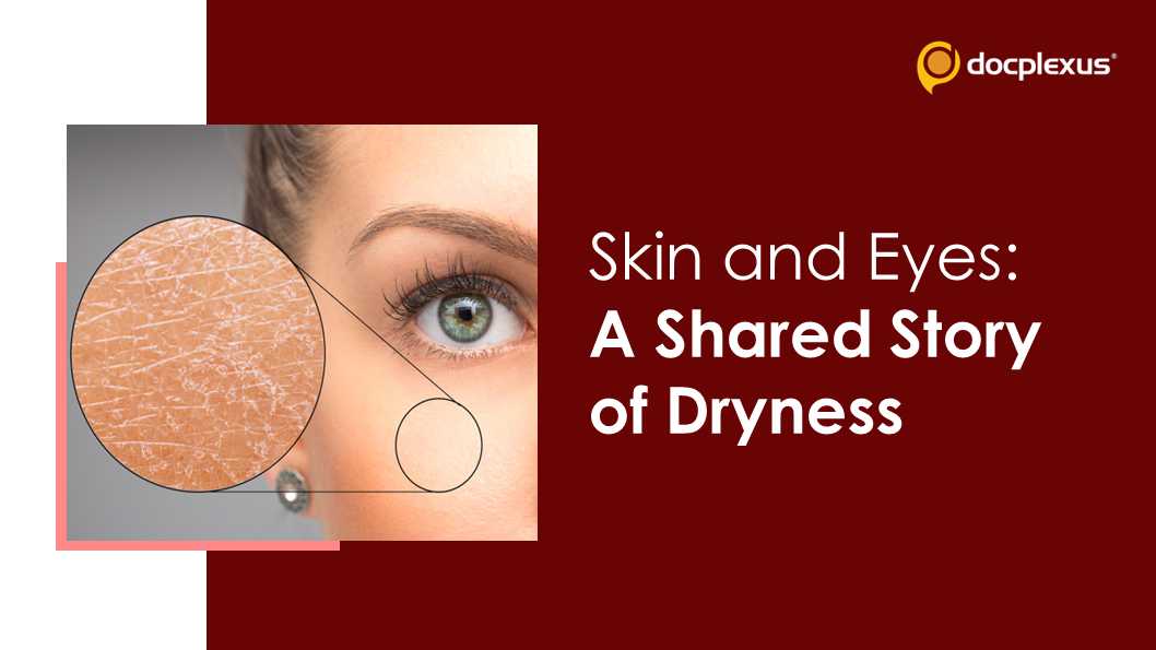 Recognizing the Connection Between Dry Eyes and Dry Skin