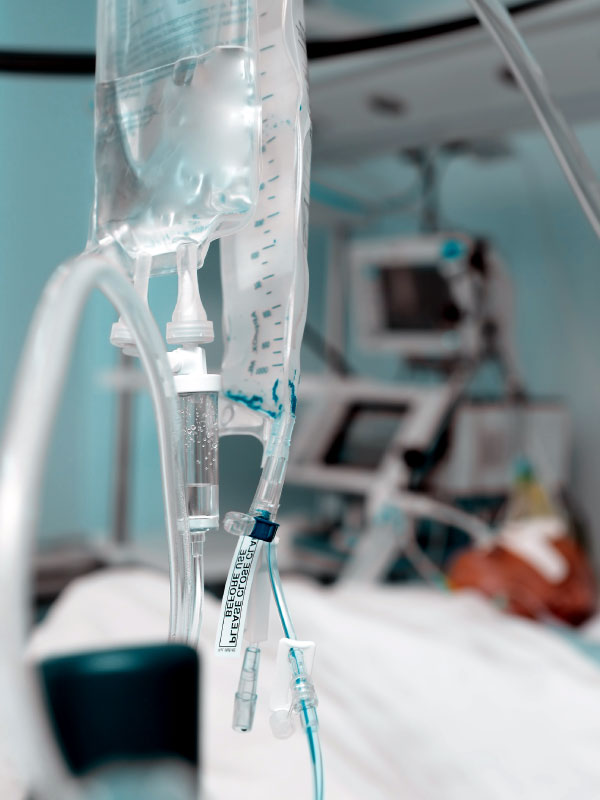 Principles of Fluid Therapy in the ICU