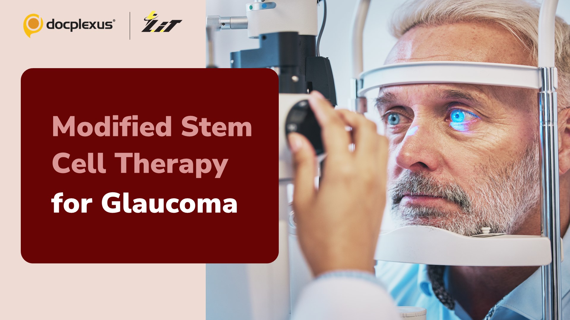 New Glaucoma Treatment Strategy that Guides Stem Cells to the Retina