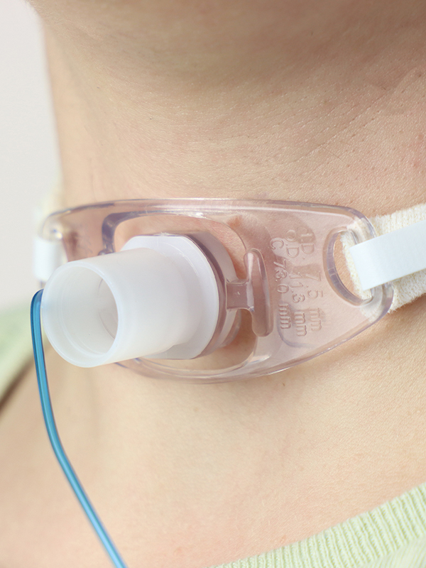 Elective Tracheostomy and Its Complications