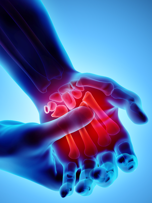 Treatment of Rheumatoid Arthritis Beyond cs-DMARD & Heart Failure