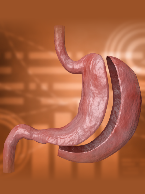 Bariatric Surgery: Addressing Weight Gain and Evolving Indications