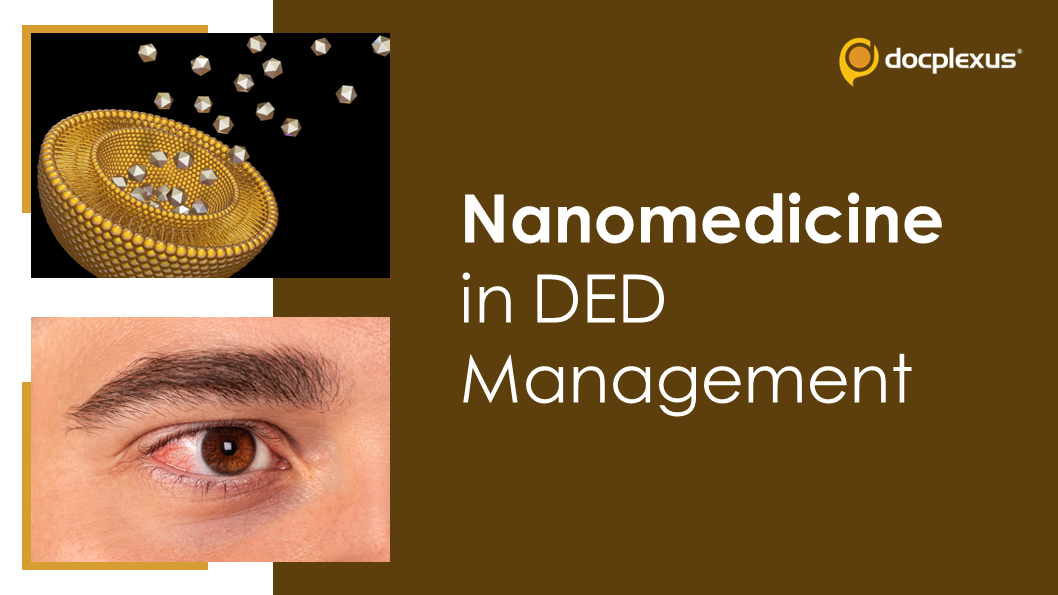 The Nanomedicine Frontier: Transforming Therapies For DED