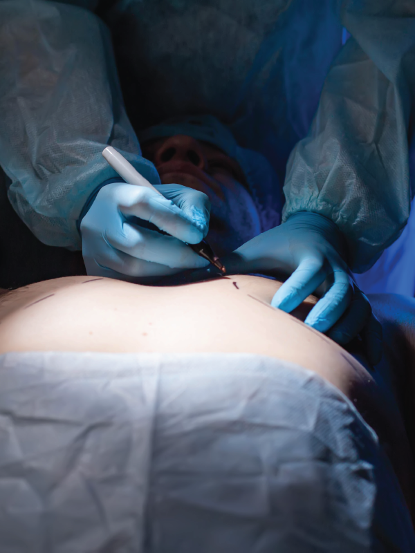 Gynecomastia and Its Treatment Options
