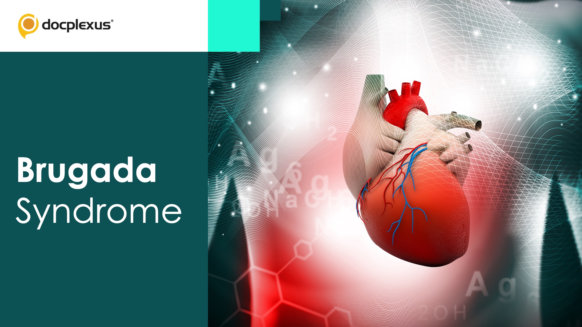 Brugada Syndrome – A Dare for Physicians