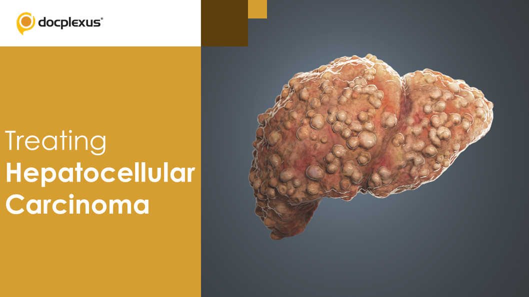 New Drug-eluting Hydrogel for Enhancing Liver Carcinoma Treatment