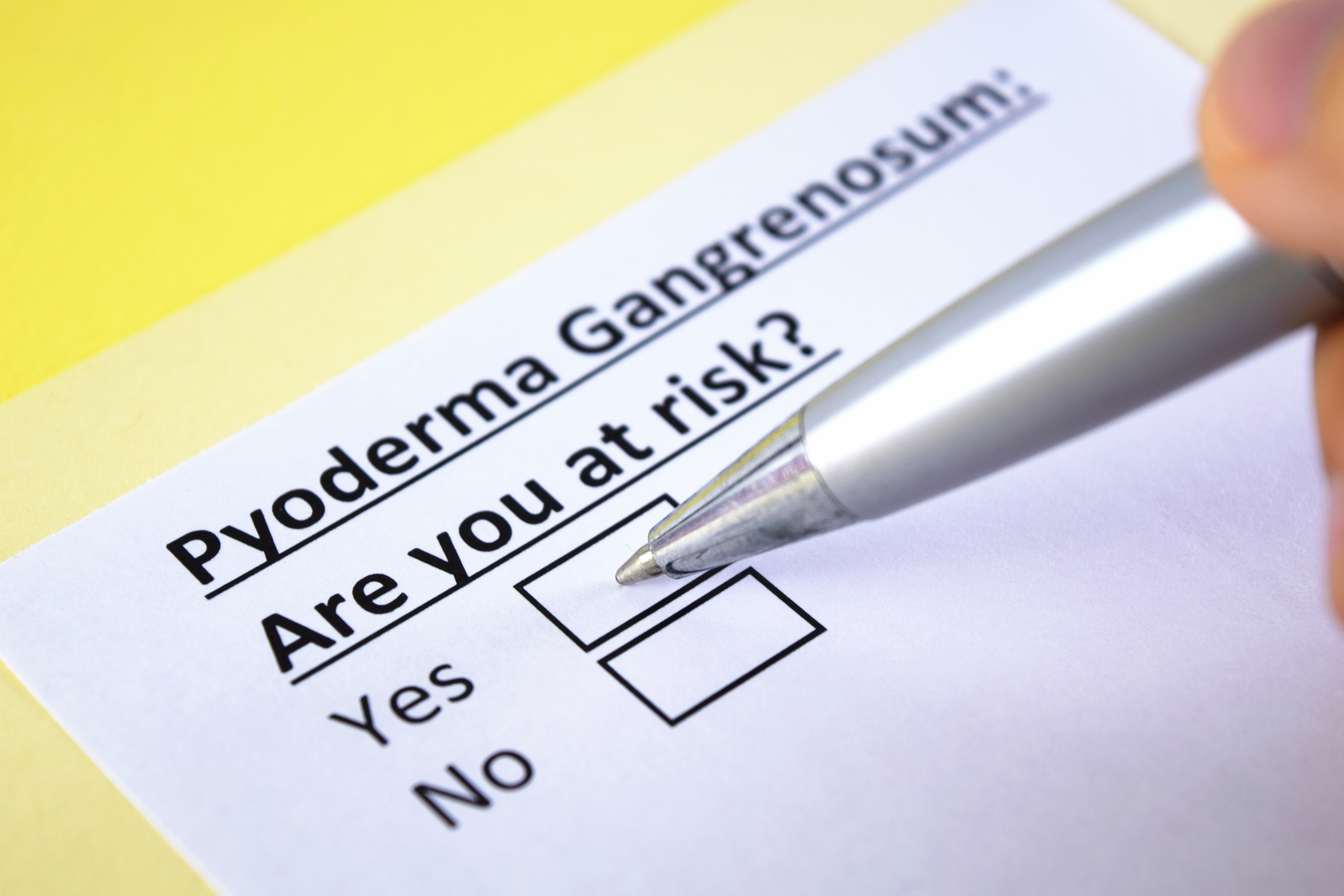 Pyoderma Gangrenosum: An Indian Perspective