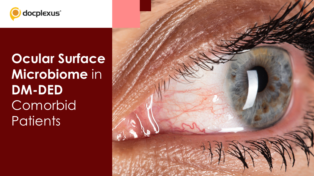 Exploring Ocular Surface Microbiome As Key Indicators In Diabetic Dry Eye Diagnosis