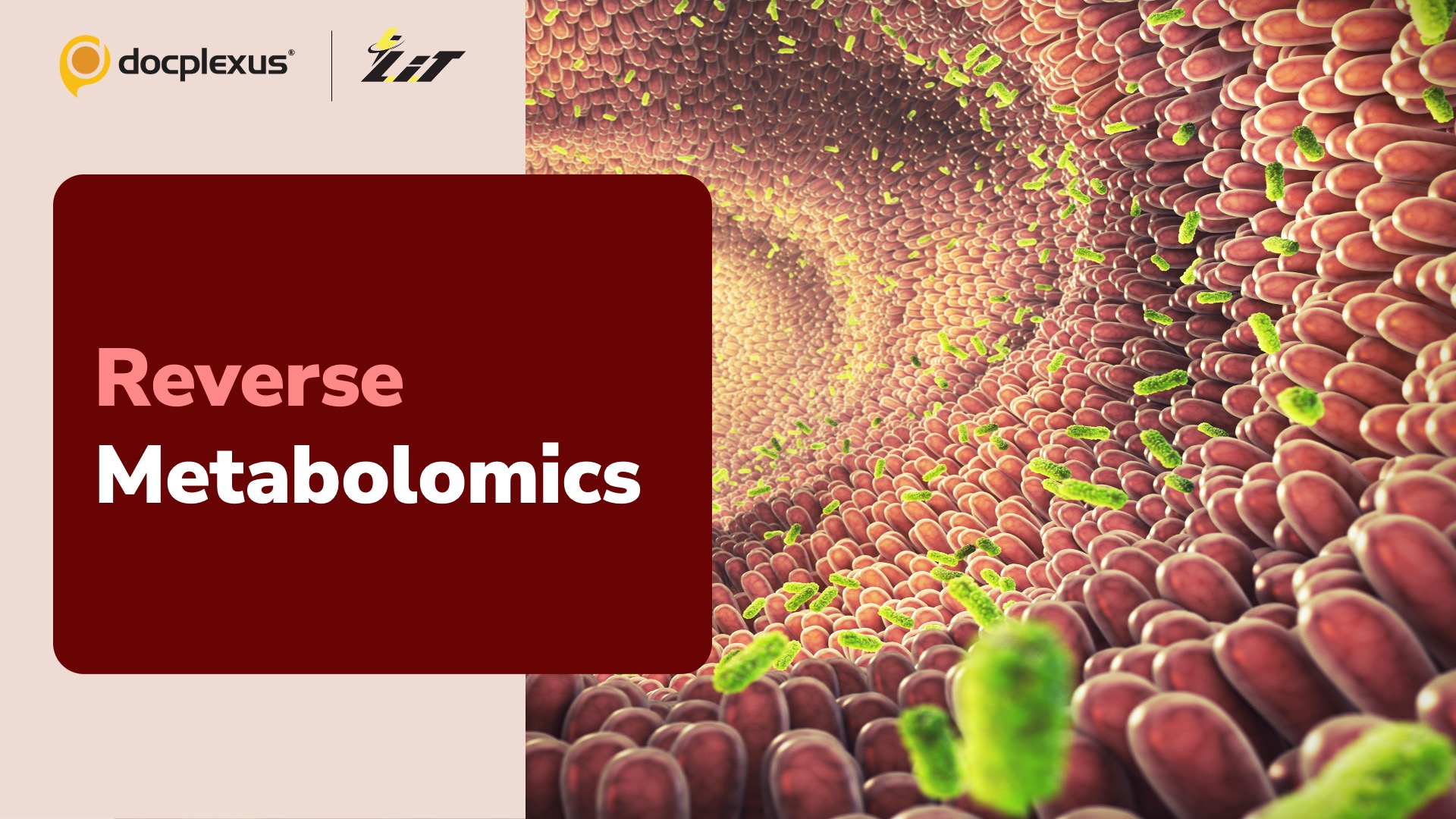 Reverse Metabolomics: A New Approach to Understanding the Human Microbiome