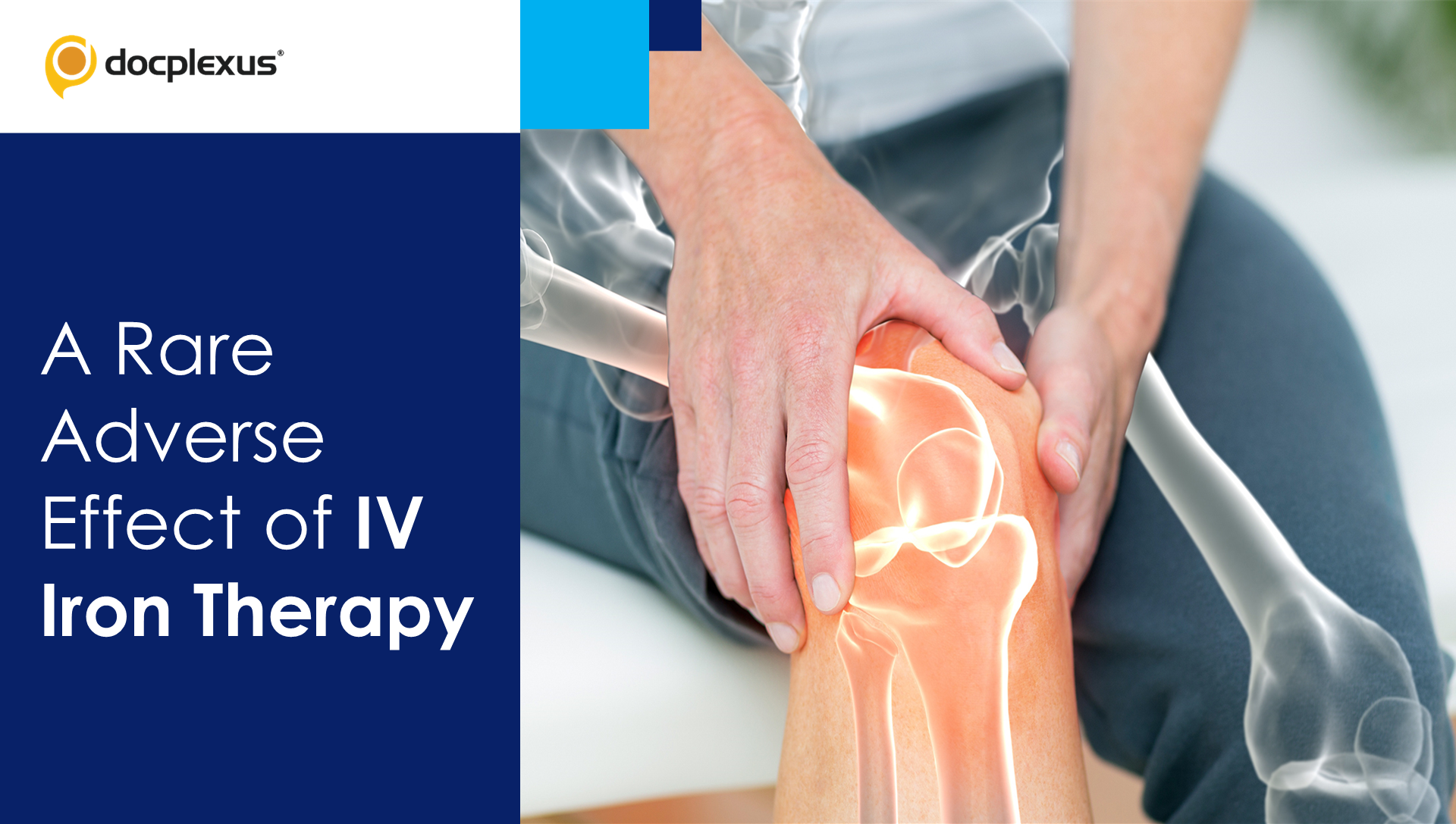 An Unusual Adverse Event Following IV Iron Therapy