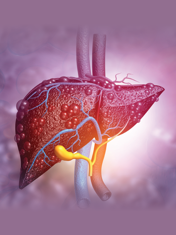 Management of HCC - From Liver Resection to Transplantation