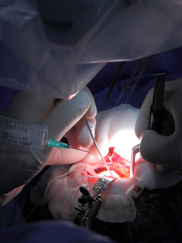 Restorative Neurosurgery