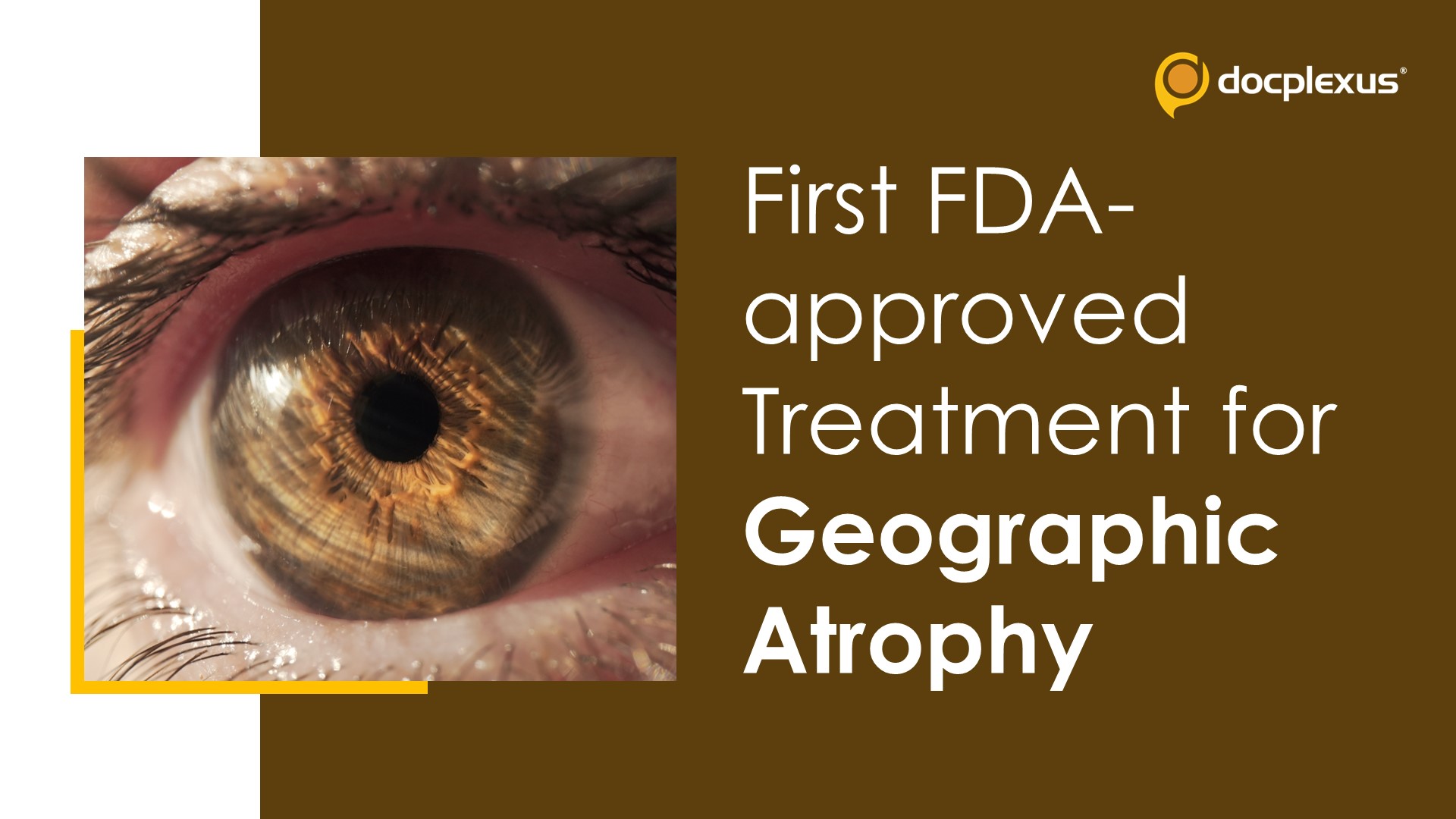 USFDA Approves Pegcetacoplan Injection for Treating Geographic Atrophy