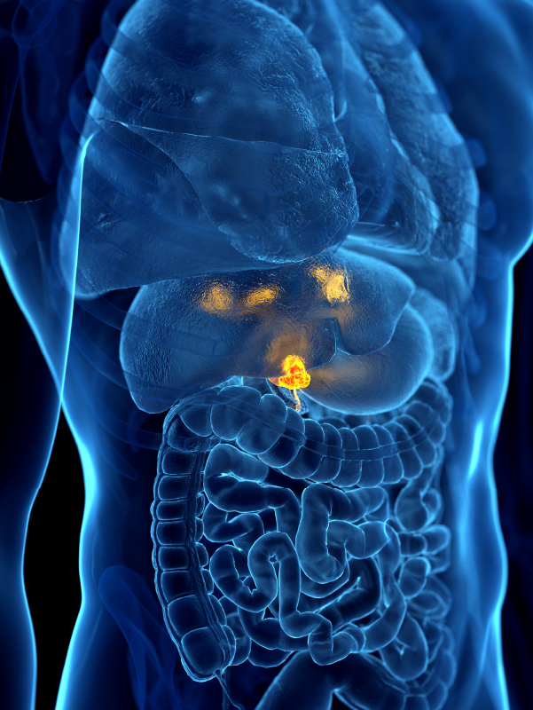 Overview of Gallbladder Carcinoma