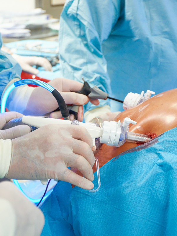 Is Surgery the Most Effective Treatment Option for Diabetes?