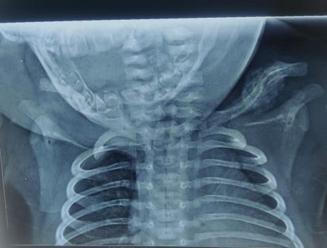 Can You Spot The Diagnosis For This Patient?