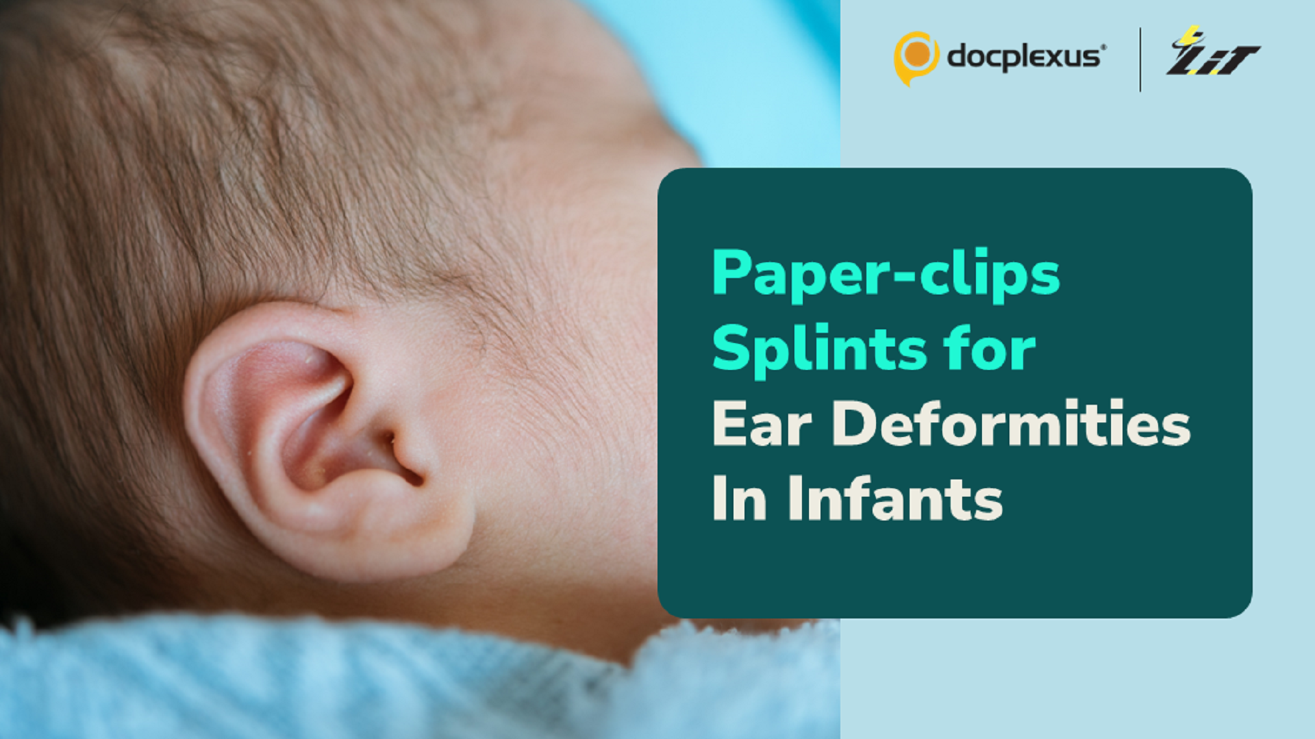 Paper-clip Splints to Treat Ear Deformities in Infants