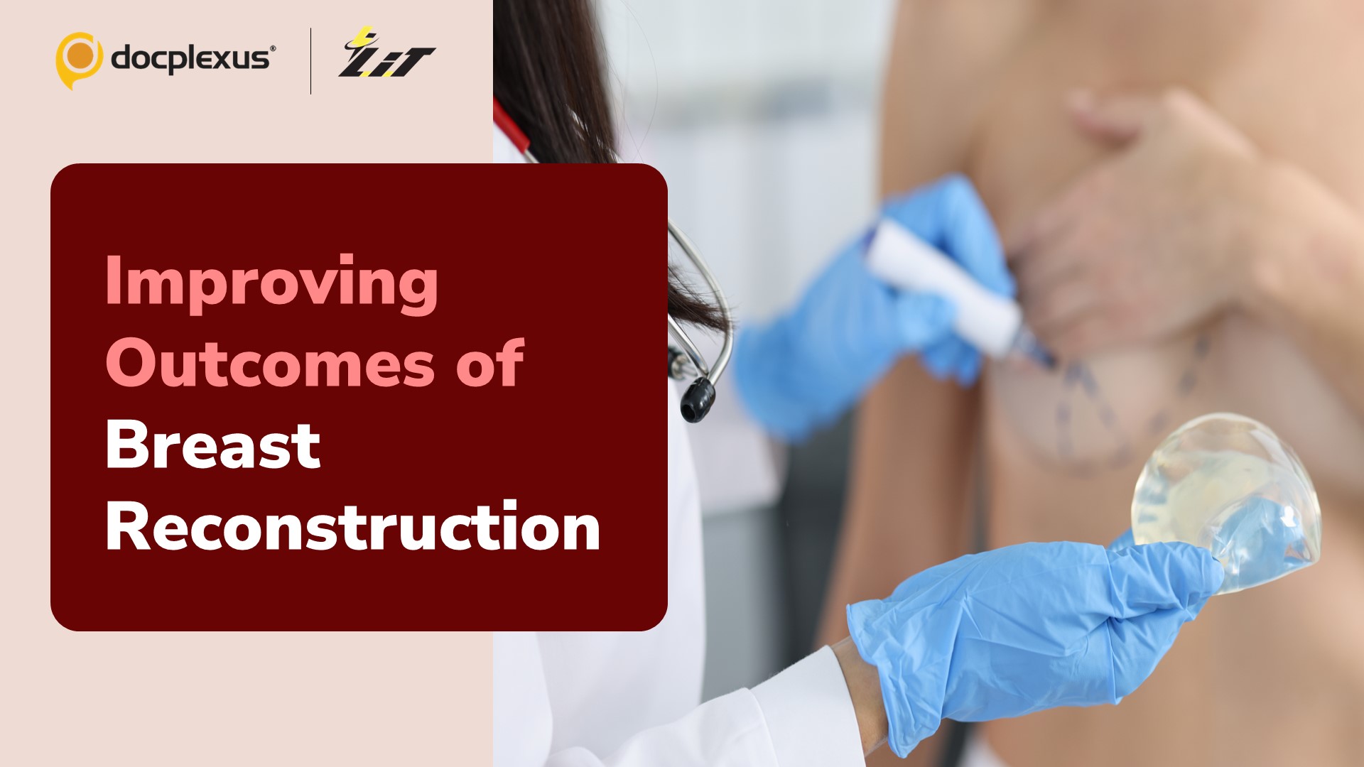 3D-printed Scaffold and Breast Reconstruction