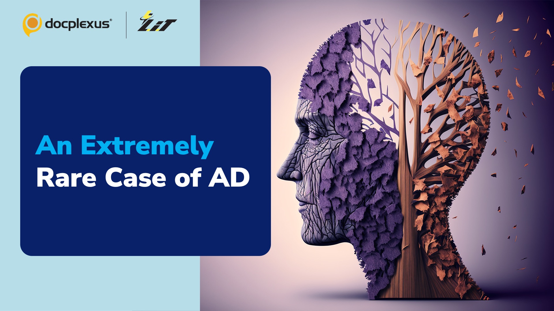 An Extremely Rare Case of Alzheimer’s Disease in a 19-year-old Patient