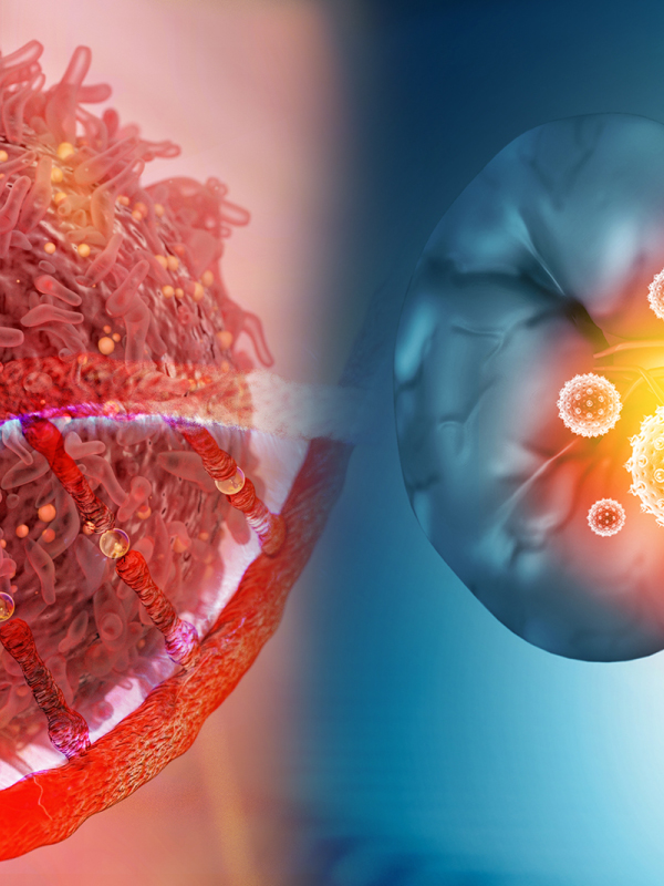 Immunotherapy | BPH | Kidney Disease Management