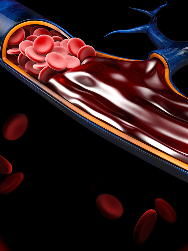 Functional Anatomy of the Veno-muscular Pumps of the Lower Limbs