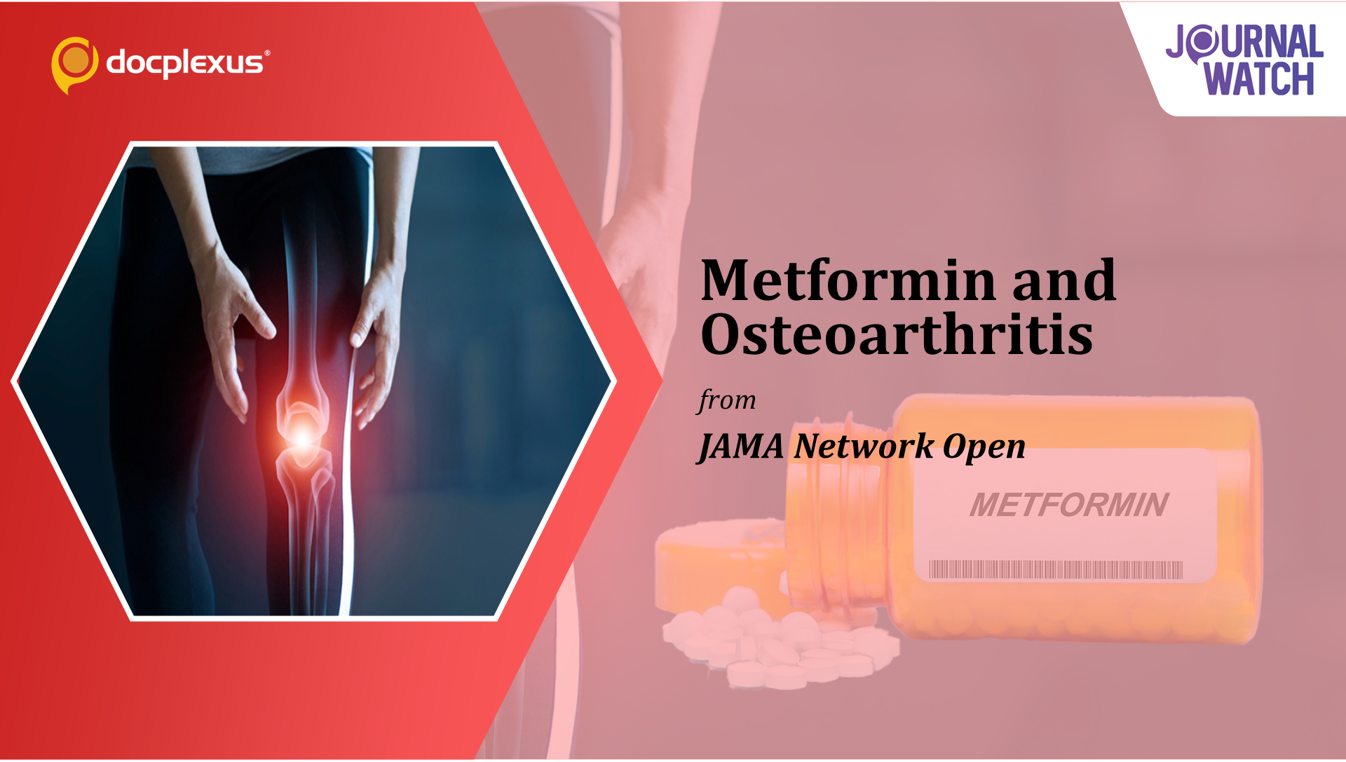 Effect of Metformin on Osteoarthritis in Adults with Type 2 Diabetes
