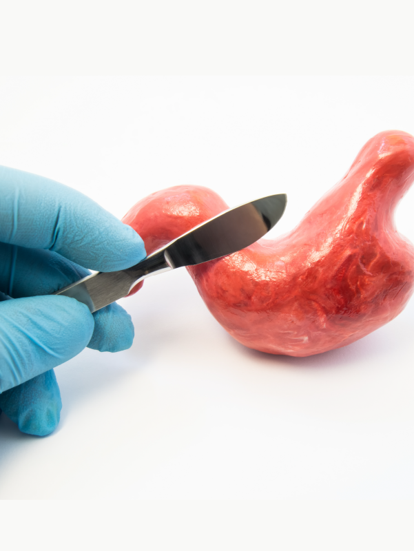 Anti-reflux Operations - Is Surgery Giving Way to Endotherapy? | Revisions for Failed Anti-reflux Operations